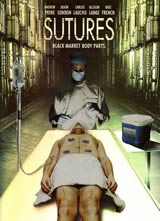 ҽ(SUTURES)