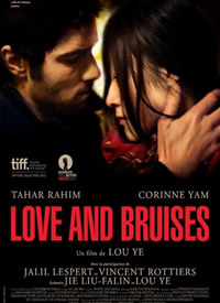  Love and Bruises